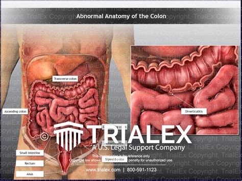 Transverse Colon