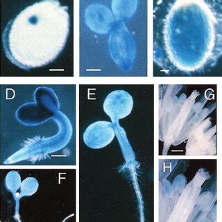 Proposed model of regulatory interactions among the ABI loci, ABA, and... | Download Scientific ...