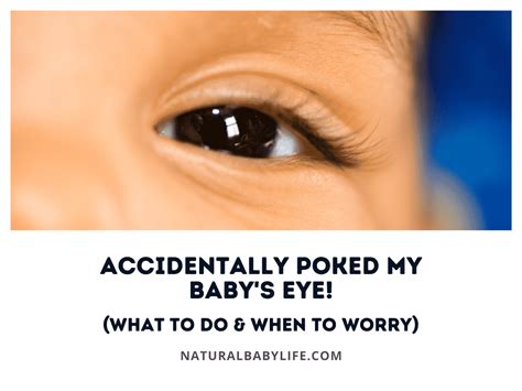 Accidentally Poked My Baby's Eye! (What To Do & When To Worry)