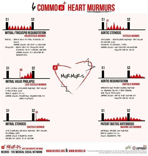 What Does Heart Murmur Sound Like