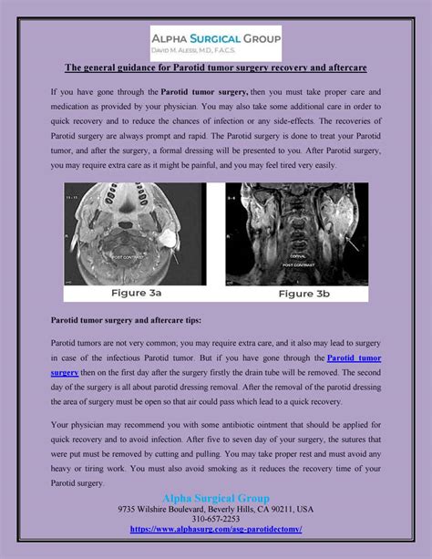 The general guidance for Parotid tumor surgery recovery and aftercare ...