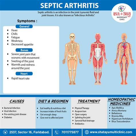 Septic Arthritis – SHATAYU MULTI-SPECIALITY CLINIC