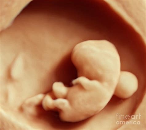 6 Week Foetus, 3-d Ultrasound Scan Photograph by Bernard Benoit - Fine Art America