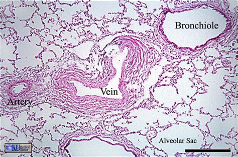 lungs histology - Google 検索 | Biology labs, Histology slides, Medical ...