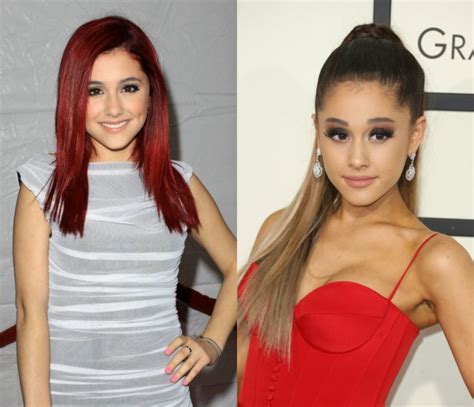 Ariana Grande Before & After: The Power of Plastic Surgery! - Demotix.com