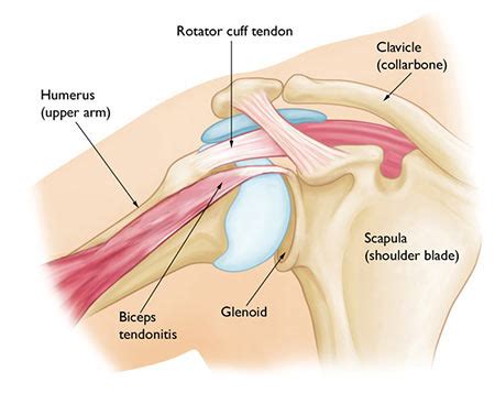 Shoulder Strain Treatment Doctor NYC · Sports Injury Clinic