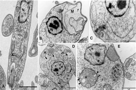 Transmission electron micrographs of Leishmania donovani. (A) General ...