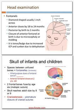 Closure of Fontanels ... #Fontanelle #Posterior #Anterior Midwifery Student