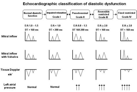 Congestive Heart Failure - Diastolic Topic Review | LearntheHeart.com | Echocardiogram ...