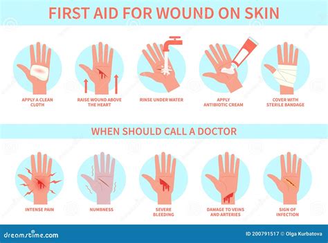 First Aid for Wound on Skin. Damage, Bleeding Cut Hand Skin and Emergency Treatment Procedure ...