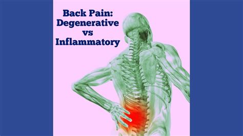 Back Pain- Inflammatory versus Degenerative - Chicago Arthritis and Regenerative Medicine