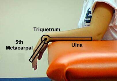 Goniometer of wrist flexion (80): over triquetrum (falcrum), lateral midline of… | Physical ...