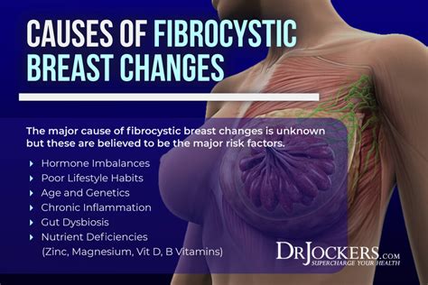 Fibrocystic Breast Changes: Causes, Symptoms & Strategies