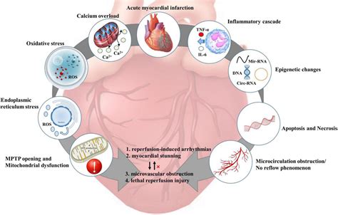 Pathophysiological mechanism of myocardial ischemia-reperfusion injury... | Download Scientific ...