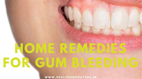 Home Remedies For Gum Bleeding in 2020 | Gum treatment, Bleeding gum, Swollen gum