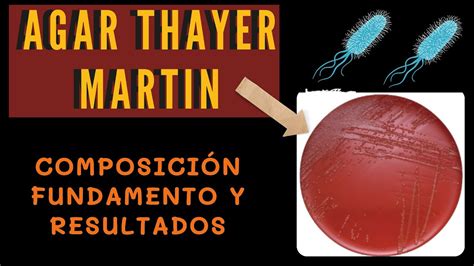 Agar Thayer Martin l THAYER MARTIN MEDIO DE CULTIVO l THAYER MARTIN FUNDAMENTO l MEDIOS DE ...