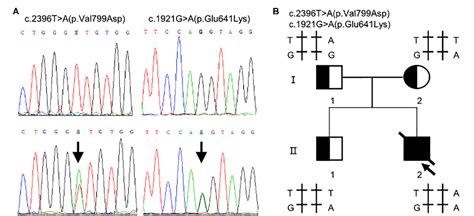 Figure 1 from Novel Compound Heterozygous TMPRSS15 Gene Variants Cause ...