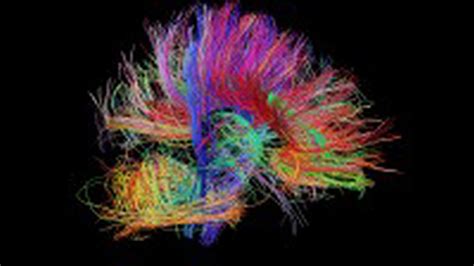 How the Brain's Wiring Forms Thoughts and Emotions