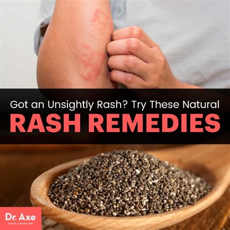 How to Get Rid of a Rash: 6 Natural Rash Remedies - DrAxe.com