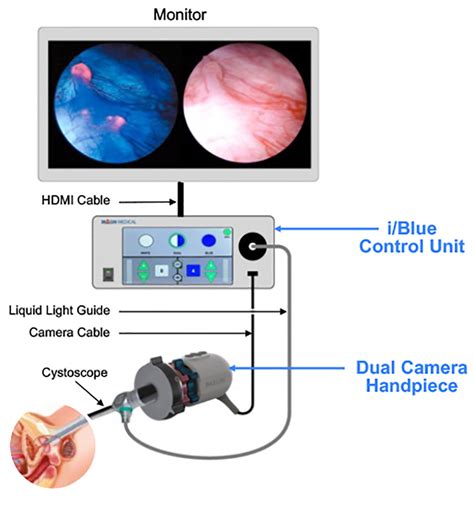 Cystoscopy Cpt 2024 - Ali Pearle