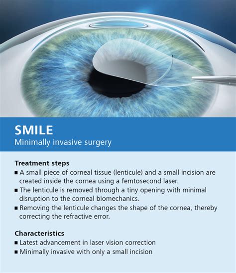 LASIK Beverly Hills | LASIK Eye Surgery Orange County | Gaster Eye