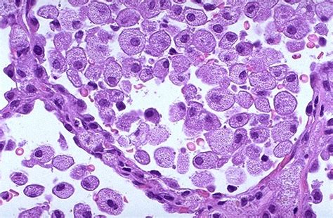 Pulmonary Pathology