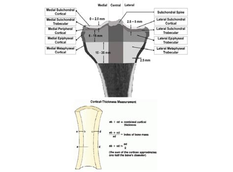 Cortical thickness measurement [9]. | Download Scientific Diagram