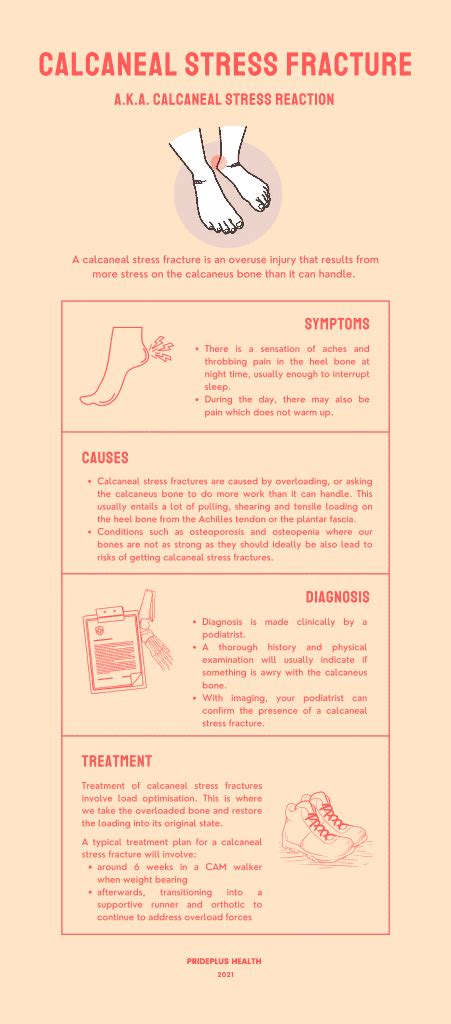 Calcaneal Stress Fracture | Heel Pain Advice