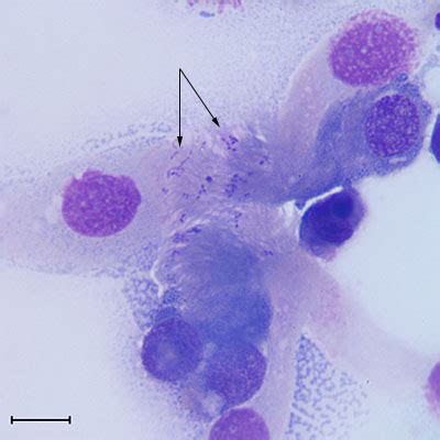 Figure 2a: High magnification of coccobacilli bacteria | eClinpath