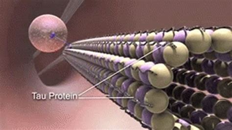 tau protein childhood epilepsy - Neuroscience News