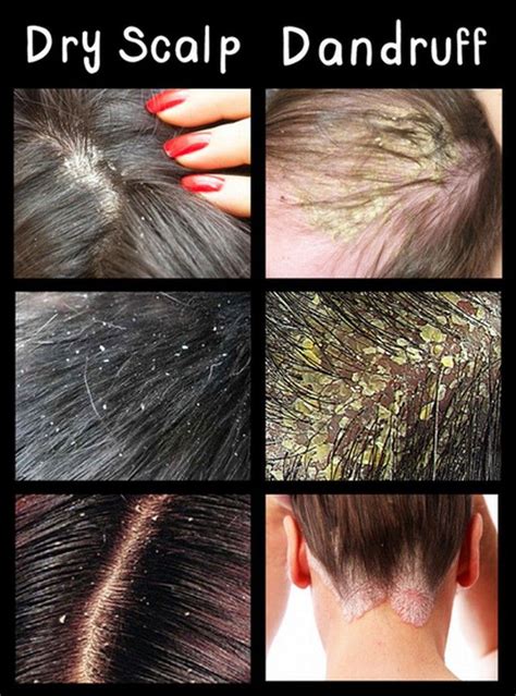 Pin on Hair Care Tips