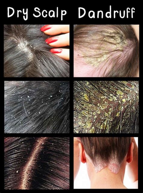 Pin on Hair Care Tips