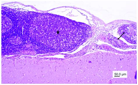 Wapiti, case 1, leptomeninges, histopathology, HE, ×40. Thickened and... | Download Scientific ...