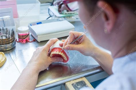 Dental prosthesis - Stock Image - C035/3073 - Science Photo Library