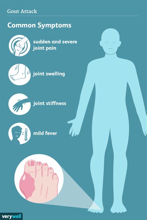 Gout Treatment