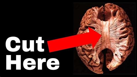 The Unsettling Truth about Human Consciousness | The Split Brain experiment that broke neuroscience