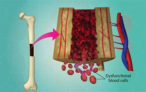 Health Condition : Symptoms, Causes, Treatment and More