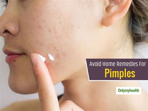 Avoid Any Random Home Remedy For Acne and Pimples, Seek These ...