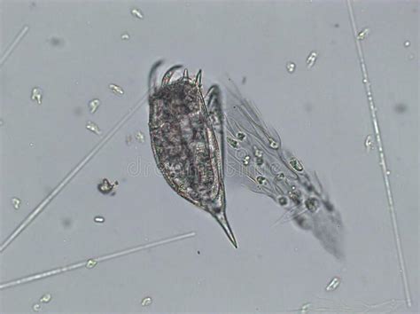 Freshwater Aquatic Zooplankton and Algae Under Microscope View Stock Image - Image of ...