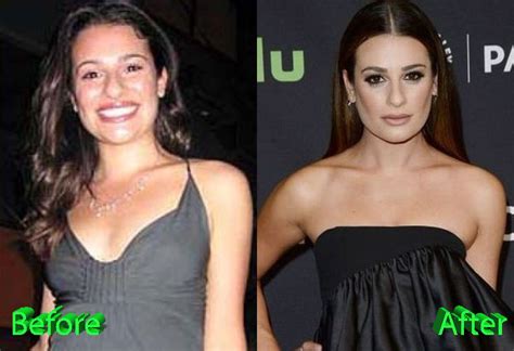 Lea Michele Nose Job: Rumors And Allegations About It