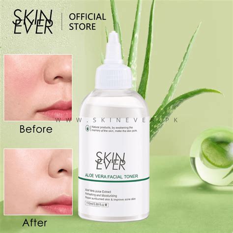 Skin Ever Aloe Vera Smoothing Facial Toner - 110ml - Eshaistic.pk