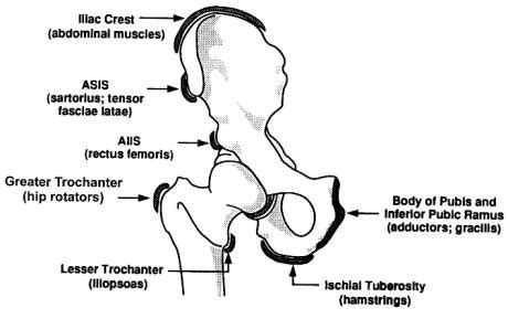 Anterior Superior Iliac Spine (ASIS) Avulsion - Knee & Sports - Orthobullets