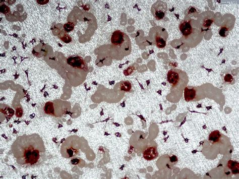 Human osteoclast & resorption trails #1 - Bone Research Society