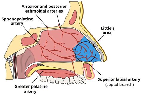 Epistaxis - Cautery - Packing - Ligation - TeachMeSurgery