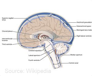 Intracranial Hypertension - Causes, Risk factors, Symptoms, Diagnosis & Treatment