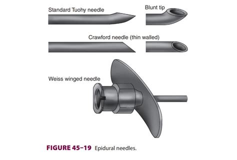 Epidural Needles and Epidural Catheters