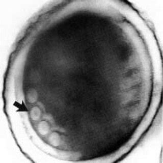 Clinical Signs, Diagnosis, and Treatment of Encephalitozoon cuniculi Infection in Rabbits ...