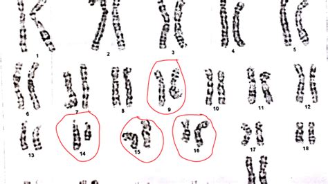 Dna Chromosome Chart