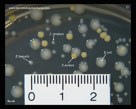 Staphylococcus Aureus Colony Morphology