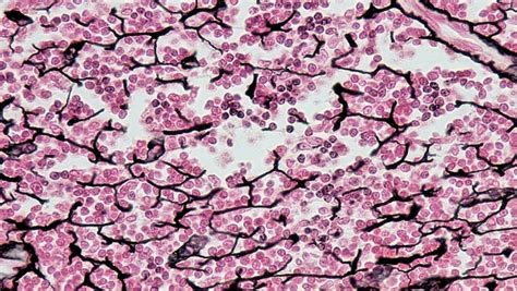 Reticular Tissue Histology